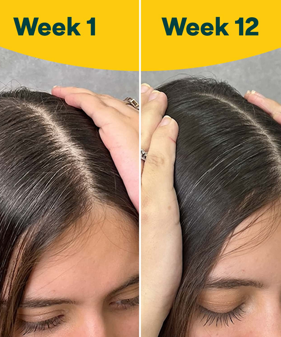 Oziva Hair Vitamins