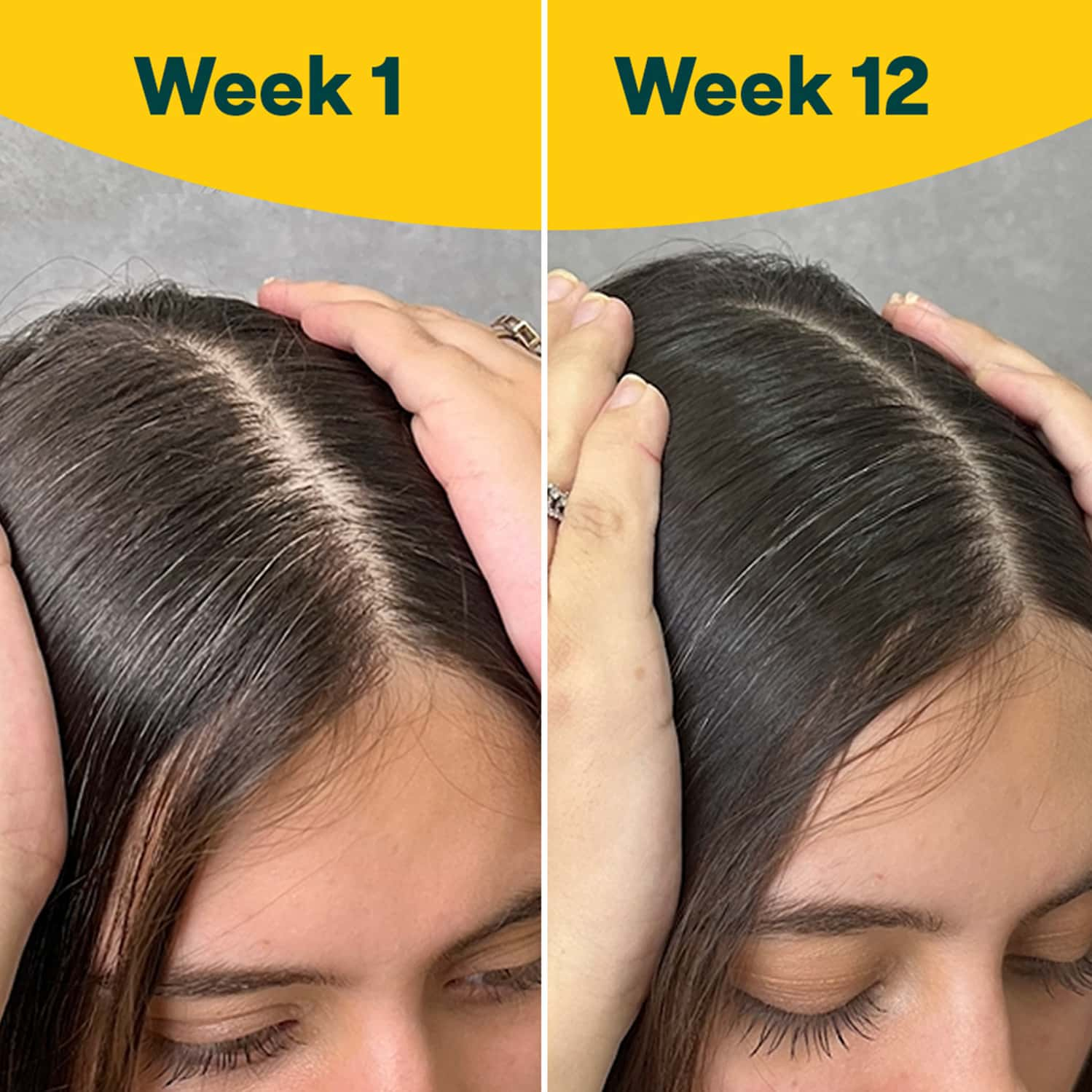 Oziva Hair Vitamins