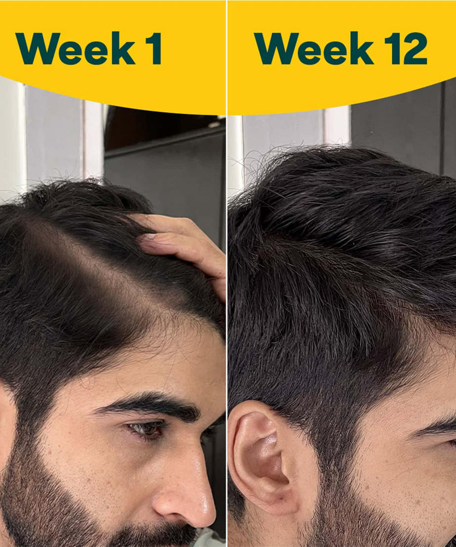 Oziva Hair Vitamins