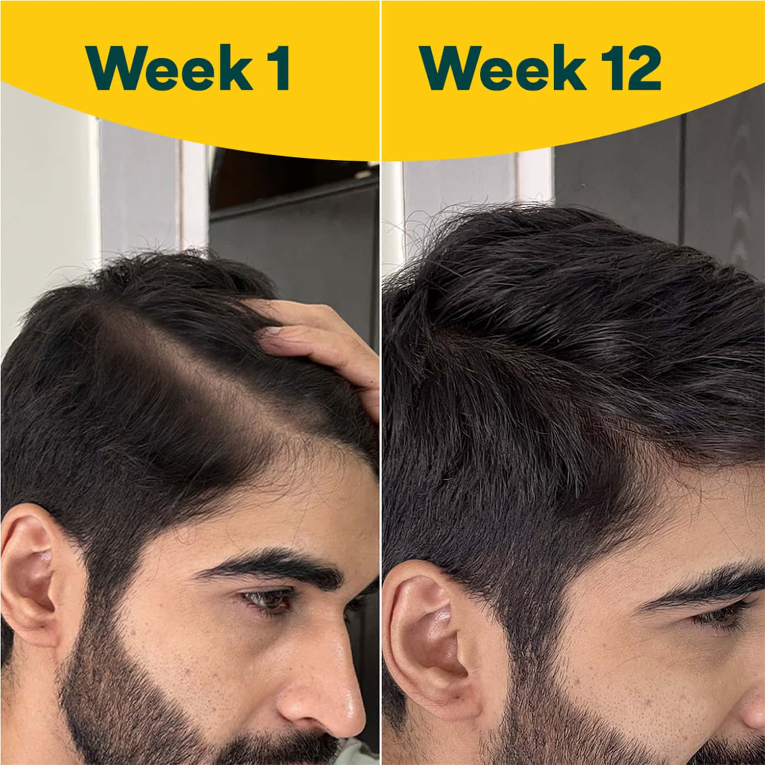Oziva Hair Vitamins